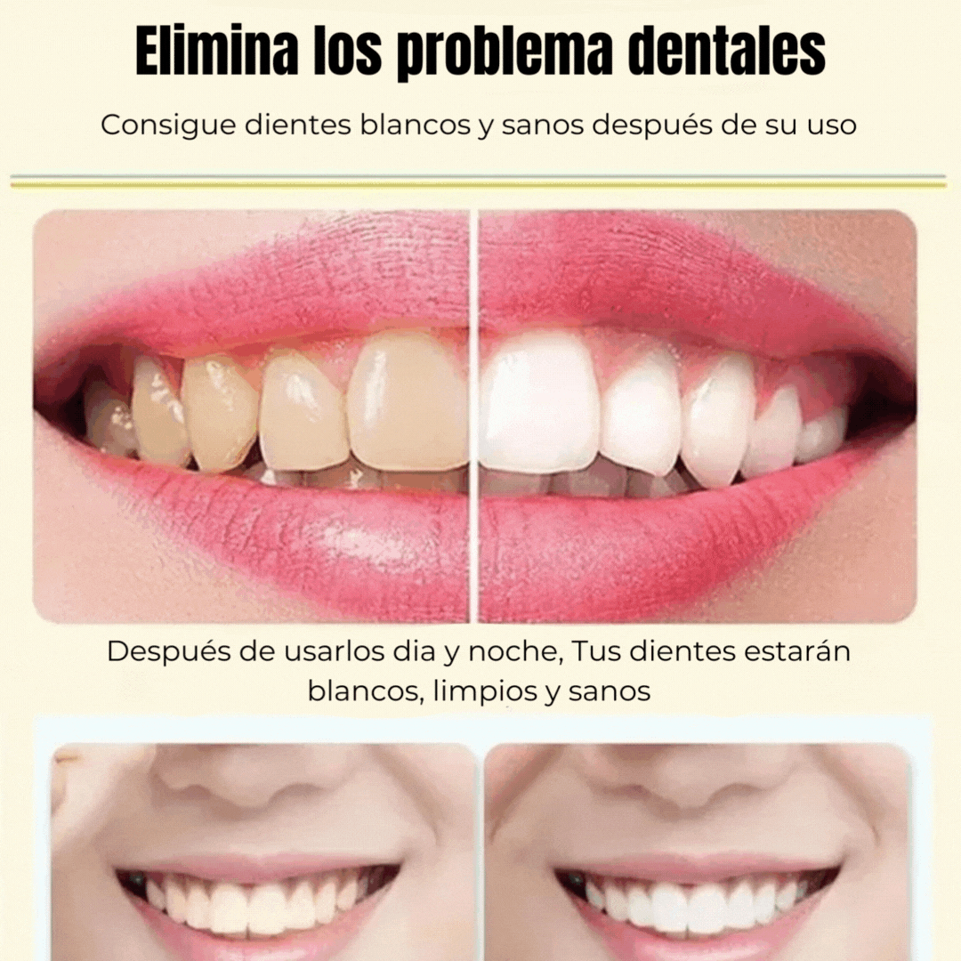 Crema de dientes blanqueamiento instantáneo + ENVIO GRATIS